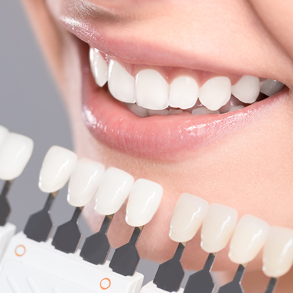 same-day-dental-crowns-op