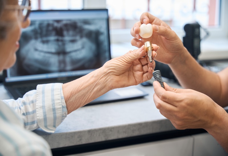 A dentist showing a patient the components of a dental implant during a consultation in Parker, CO