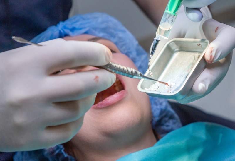 A dentist is offering a dental bone grafting procedure in Parker, CO