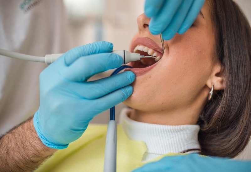 Close-up of a patient receiving dental cleaning in Parker, CO