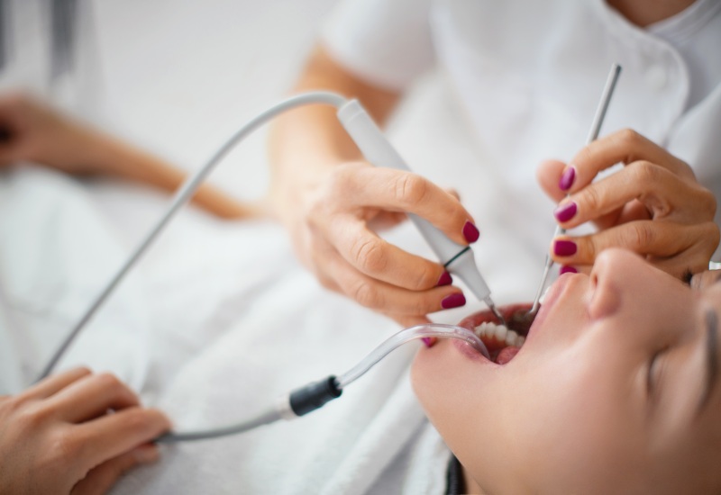 Dental professional performing tartar removal treatment in Parker, CO